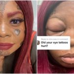 學網紅「眼睛染色」結果腫成豬頭 5寶媽視力受損快失明